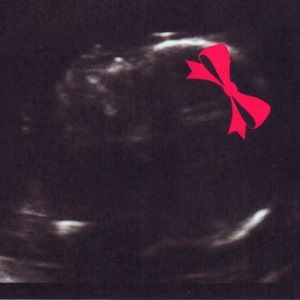 Meet your Posher, Charity